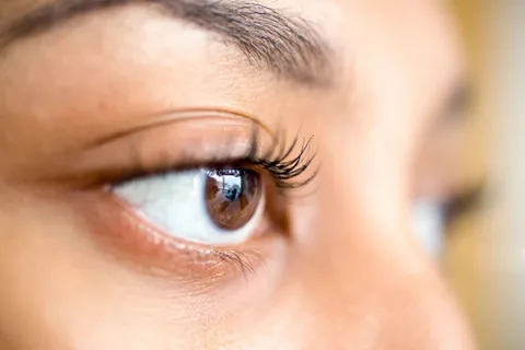 Eyelid lift in Kenya consultation for blepharoplasty and eye area concerns