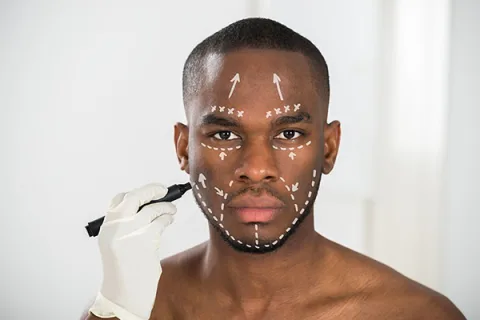 Facial implants in Kenya consultation for chin, jawline, and cheek balance