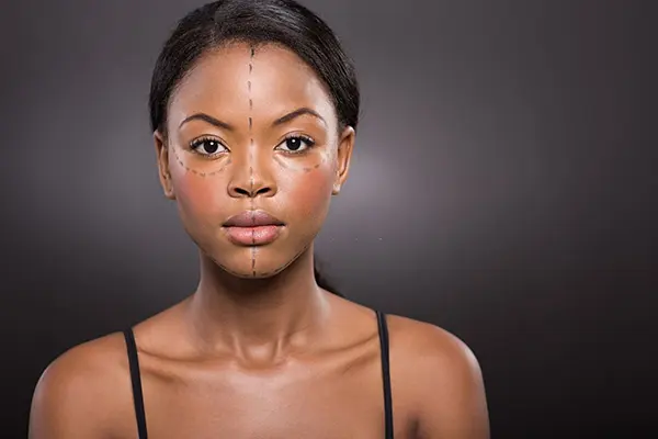 Fat transfer to the face in Kenya consultation for facial volume restoration