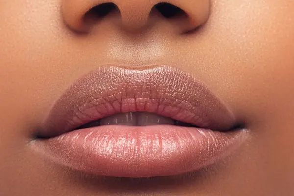 Lip lift in Kenya consultation for upper lip proportion and facial balance