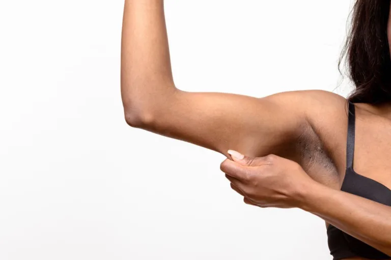 Mommy makeover in Kenya consultation for post-pregnancy body changes