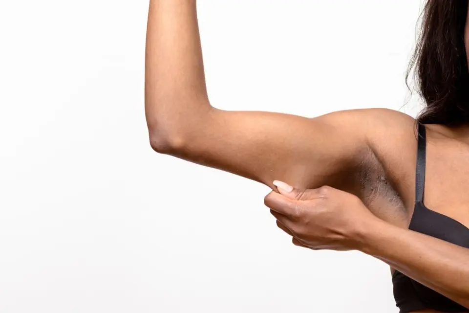 Mommy makeover in Kenya consultation for post-pregnancy body changes