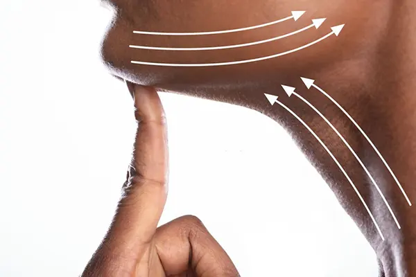 Neck lift in Kenya consultation for neck skin laxity and jawline definition