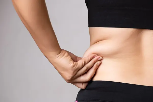 Revision liposuction in Kenya consultation for contour irregularities after previous liposuction