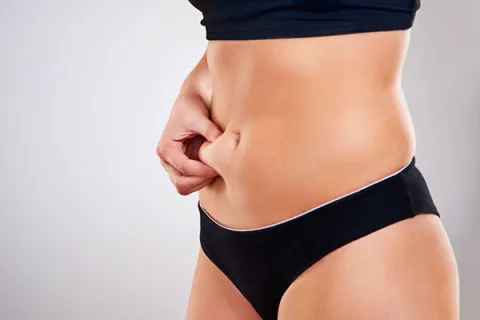 Revision tummy tuck in Kenya consultation for previous abdominoplasty concerns