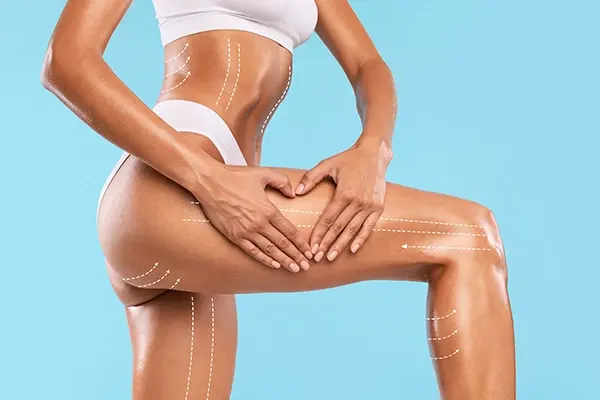 Thigh lift in Kenya consultation for loose thigh skin and body contouring