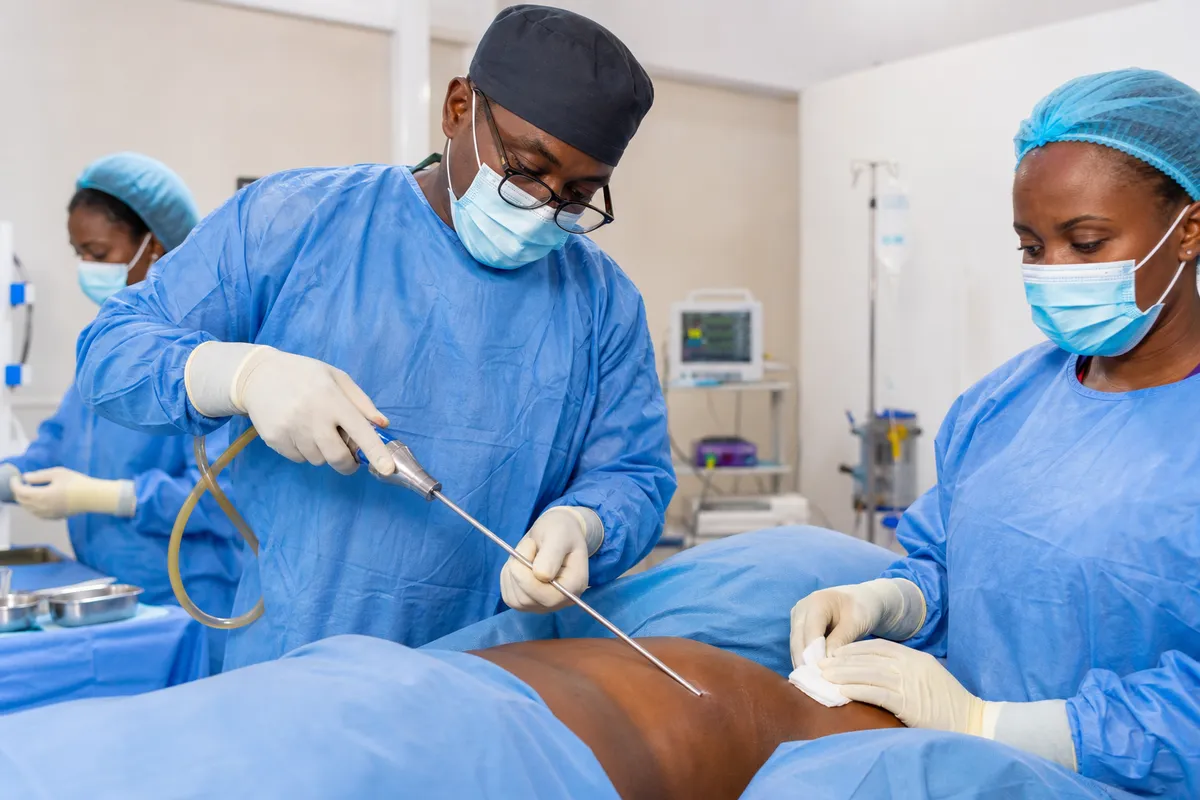A Kenyan plastic surgeon and medical team performing liposuction with sterile technique in a modern, well-lit operating room.