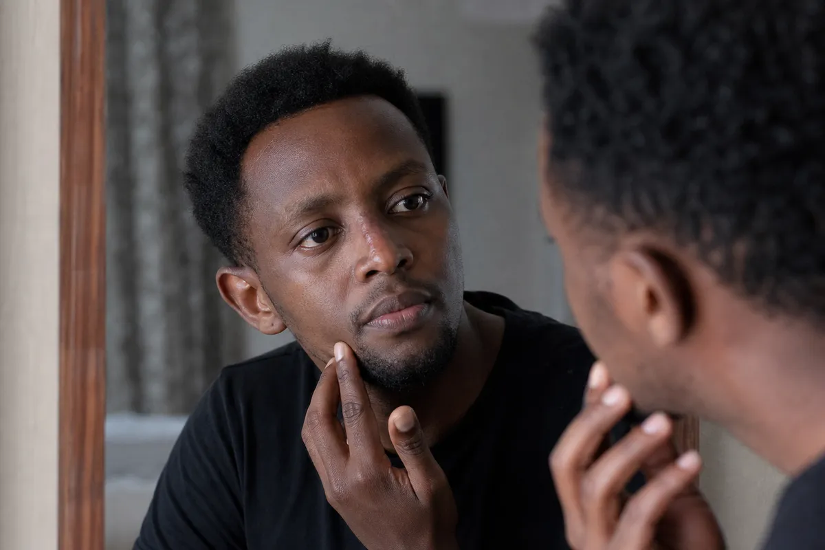Kenyan man thoughtfully checking his nose profile in a home mirror after rhinoplasty surgery with faint scars visible.