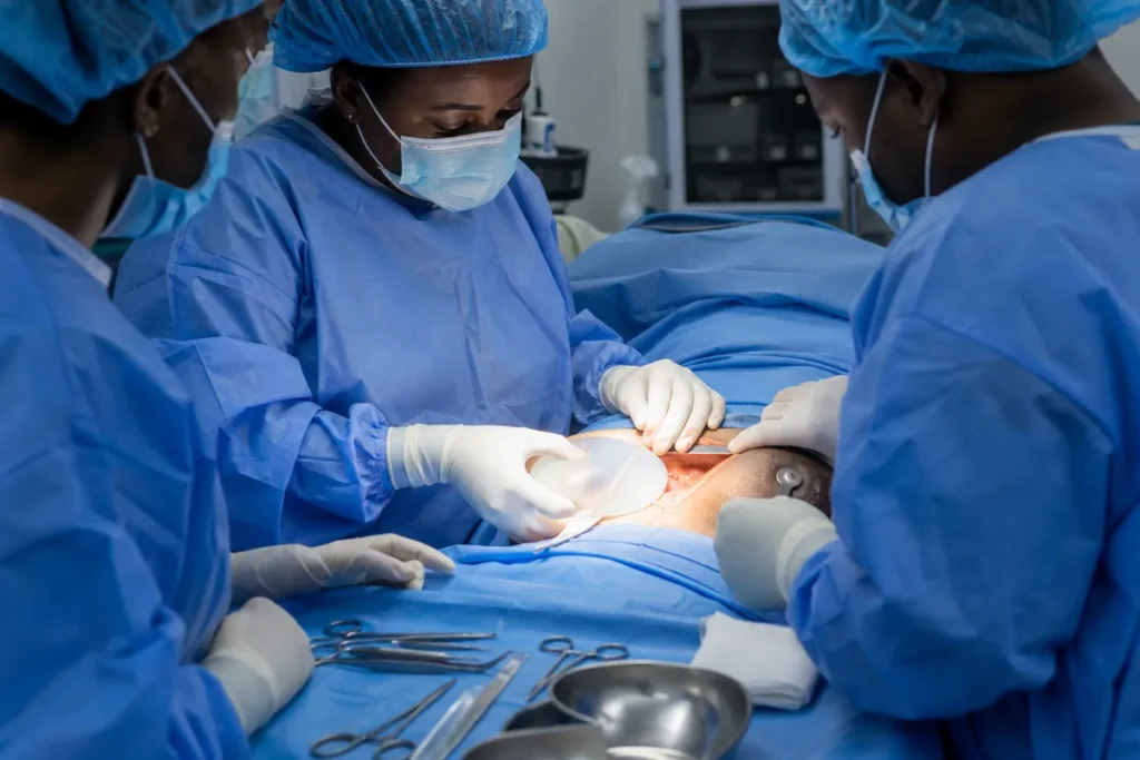 Kenyan surgeons perform implant-based breast reconstruction by positioning a tissue expander beneath the chest muscle of a patient in a sterile operating theatre.